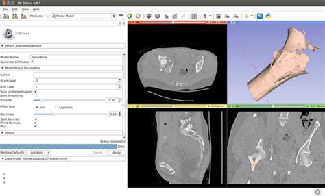 3d printing from ct scan.